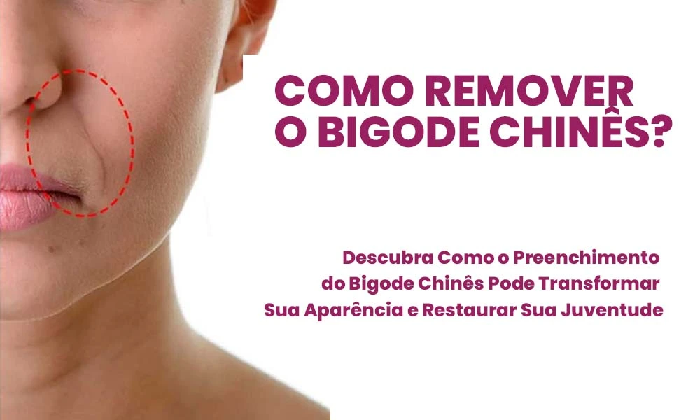 Bigode chines como remover?