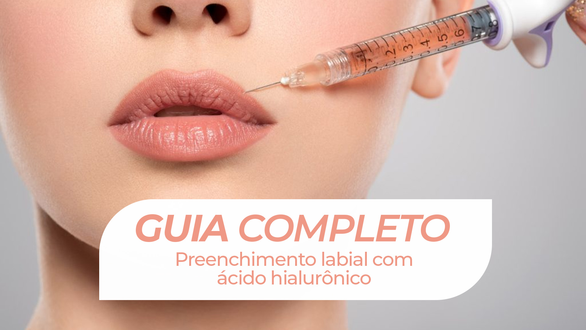 Guia Completo do Preenchimento Labial com Ácido Hialurônico