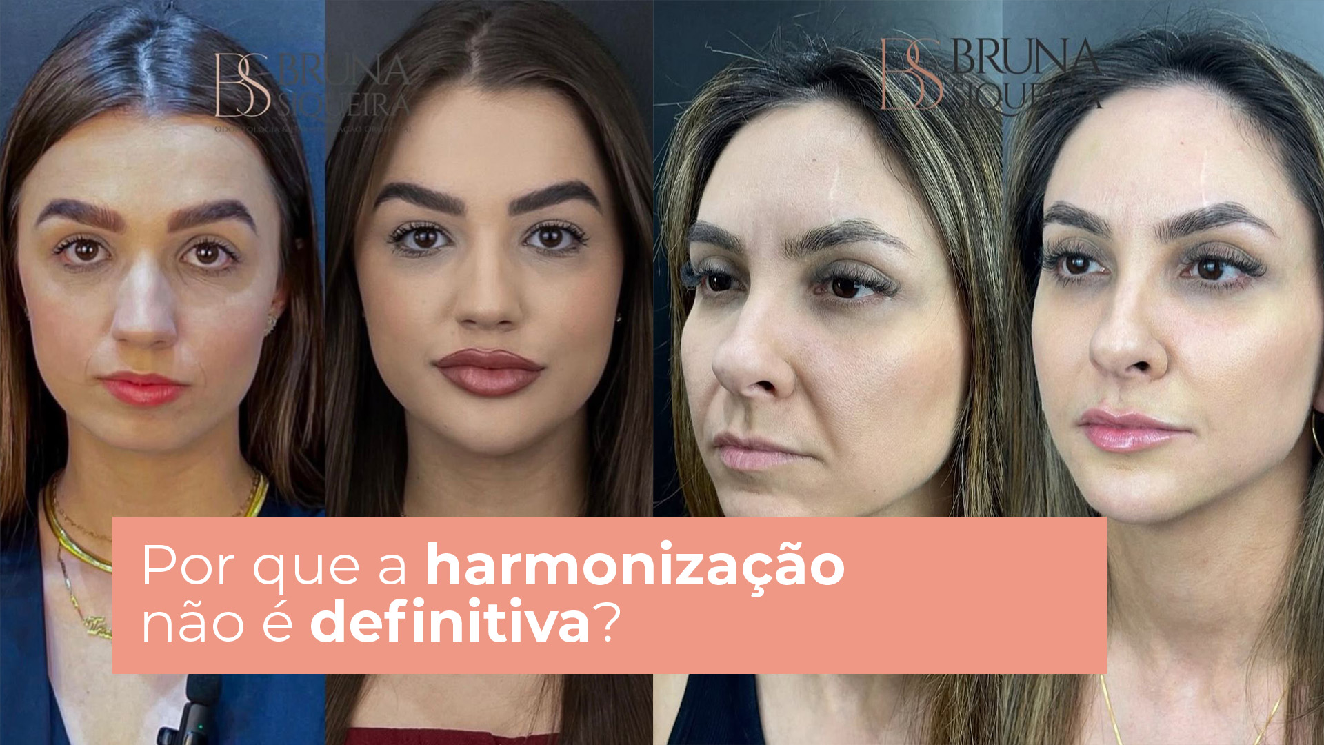 Por que a harmonização não é definitiva?